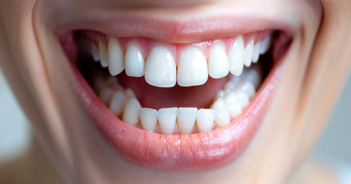 How Many Teeth Do Humans Have?